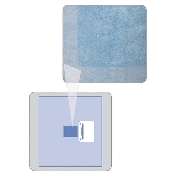 InvisiShield 48x51" Sterile Surgical Incise Drape Fenestrated