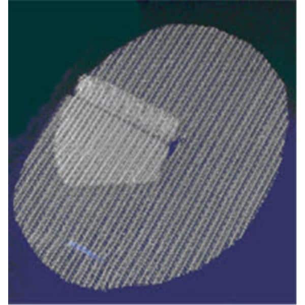 Parietex ProGrip Repair Mesh Right