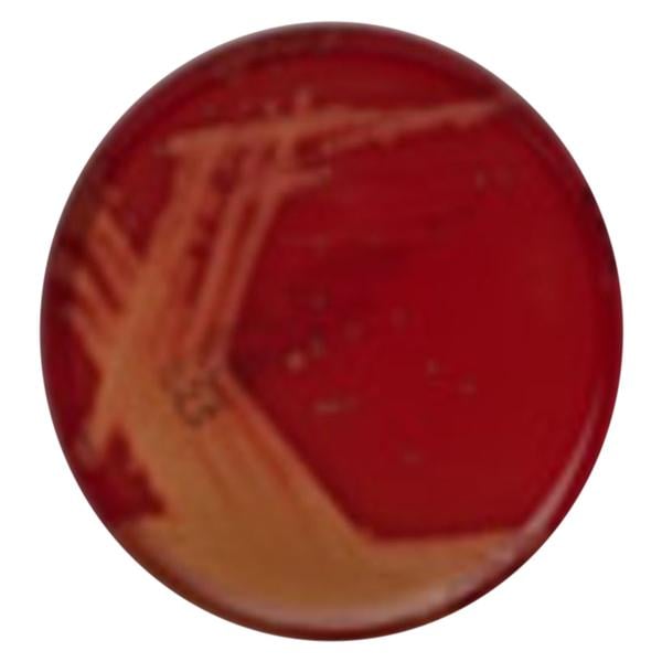 Monoplate Agar Columbia CNA w/ 5% Sheep Blood Monoplate 10/Pk