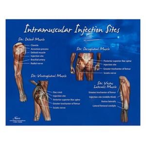 Intramuscular Injection Sites 10-1/2x14" Training Chart Ea