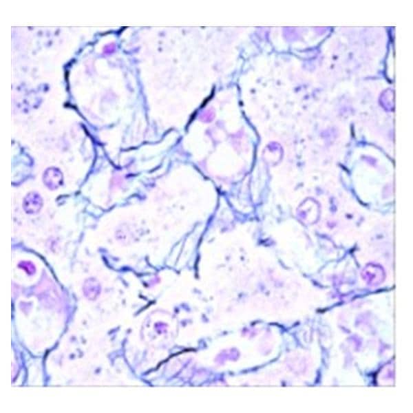 Stain Solution Nuclear Fast Red 125mL Ea