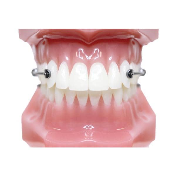 Carriere® Motion 3D™ Class II Typodont Ea