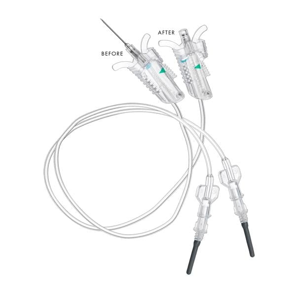 VanishPoint Blood Collection Set 21gx3/4" Dark Green Safety 12" Tubing 50/Bx, 4 BX/CA