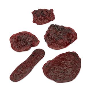 Life/form Clots/Hemorrhages Model Set Ea