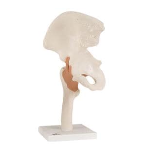 Hip Joint Functional Model Ea