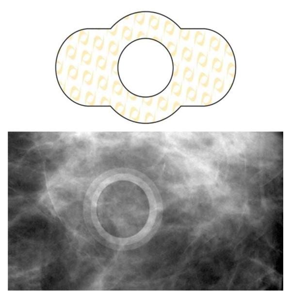 Spee-D-Ring Mole Marker 100/Bx