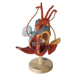 Heart of America Heart Patient Education Anatomical Model Ea