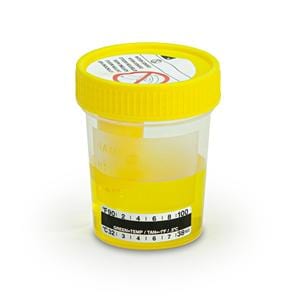 TransferTop Urine Collection Cup 120mL Plastic Sterile Bulk 300/Ca