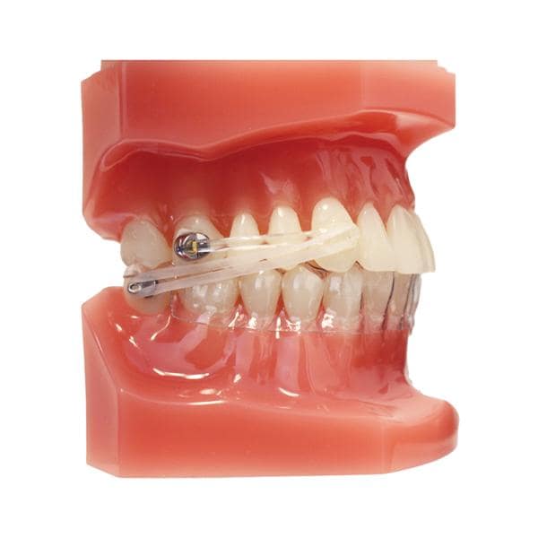 Carriere® Motion 3D™ CLEAR Class II Typodont Ea