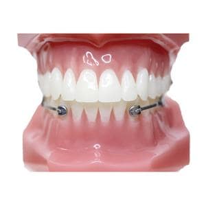 Carriere® Motion 3D™ Class III Typodont Ea