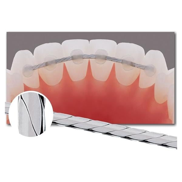 Ortho Technology Ortho Rtnr Wr SS Brded .028" Rect .010" x .028" x 6.0" 10/Pk