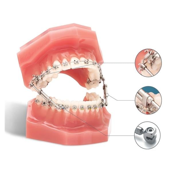 TruEase Bite Corrector 2/Pk