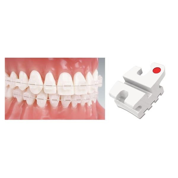 Reflections Roth Ceramic Bracket .022 U4/5 With Hook 10/Pk