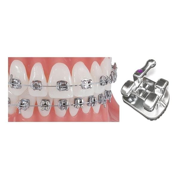 Pinnacle Roth Bracket Refill .018 UR 4/5 1 Patient Hook 10/Pk