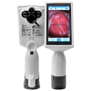 EVA Pro Digital Colposcope Zoom