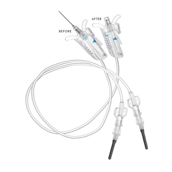 VanishPoint Blood Collection Set 23gx3/4" 12" Safety 200/Ca