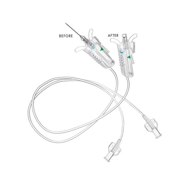 VanishPoint Blood Collection Set 21gx3/4" Winged 12" Safety 200/Ca