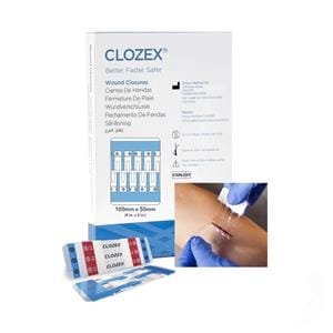 Clozex Wound Closure Device 4x2" Clear 10/Bx