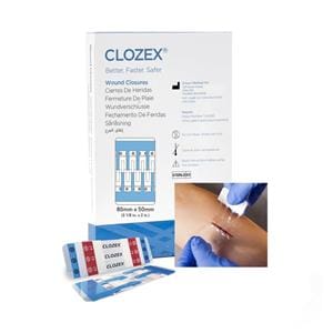 Clozex Wound Closure Device 3-1/8x2" Clear 10/Bx
