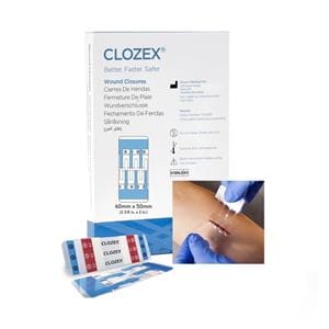 Clozex Wound Closure Device 2-3/8x2" Clear 10/Bx