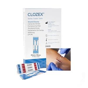 Clozex Wound Closure Device 1-1/2x2" Clear 10/Bx