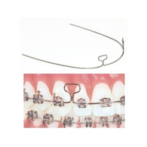 TruForce Archwire Retraction T-Loop Stainless Steel 0.017 in x 0.025 in 10/Pk