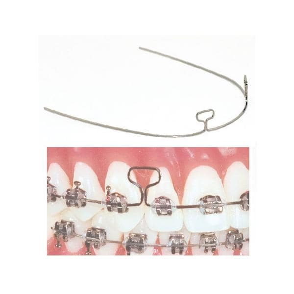 TruForce Archwire Retraction T-Loop Stainless Steel .019 in x .025 in 10/Pk