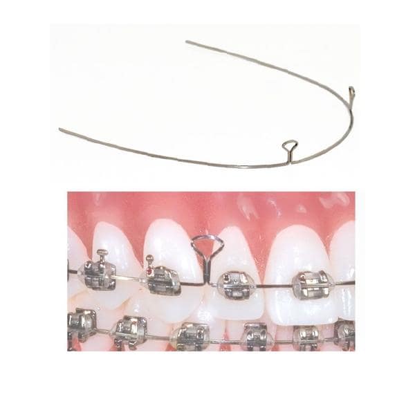 TruForce 2 Keyhole Retraction Archwire SS Anterior 0.019 in x 0.025 in 10/Pk