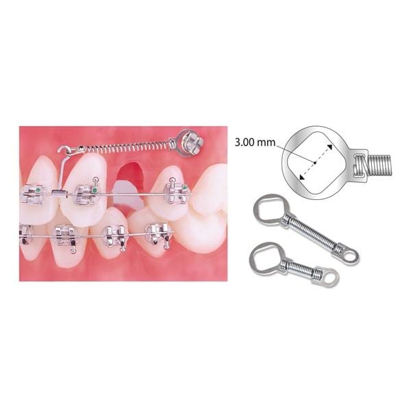 TruFlex TAD Coil Spring Heavy Force Closed NiTi 12 mm 0.012 in x 0.030 in 10/Pk product image