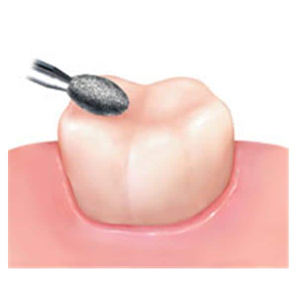 NTI Diamond Friction Grip Coarse 368-023C 50/Pk thumbnail 2