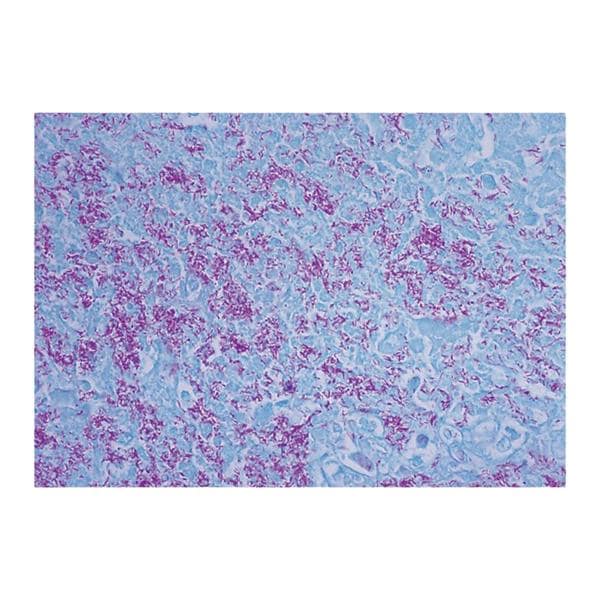 AFB: Acid Fast Bacillus Stain Kit Green Ea Ea