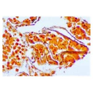 Silver Nitrate Solution 500mL Ea