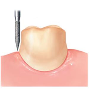 NTI Diamond Friction Grip Coarse 862-012C 50/Pk