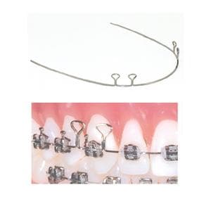 TruForce 4 Keyhole Retraction Archwire SS Anterior .019 in x .025 in 10/Pk