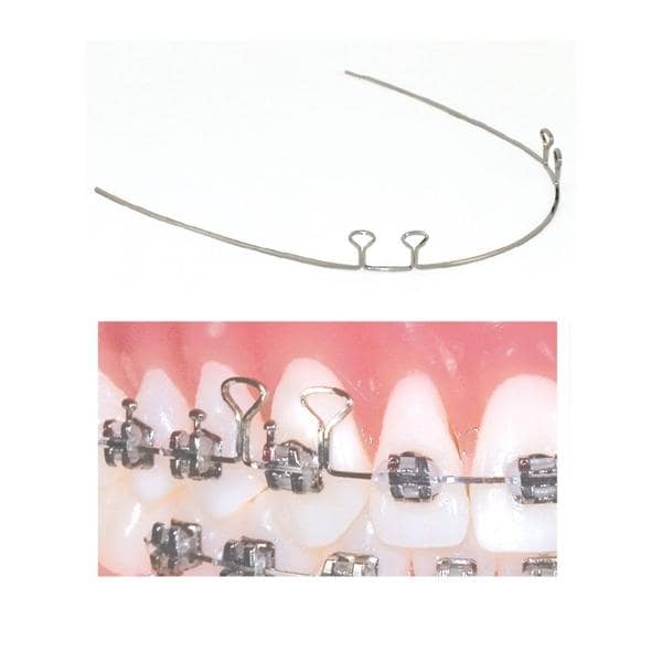 TruForce 4 Keyhole Retraction Archwire SS Anterior .019 in x .025 in 10/Pk