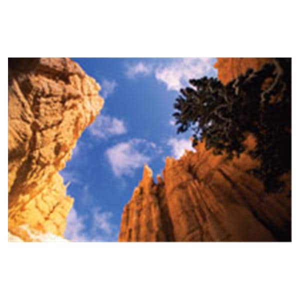 CeilingScenes Light Lens Stone Canyon 2-Tiles Vertical 24 in x 48 in Ea