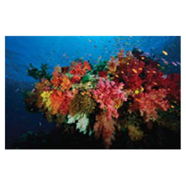 CeilingScenes Light Lens Coral Reef 1-Tile Square 24 in x 24 in Ea