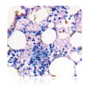 Giemsa Stain Kit May-Grunwald Ea