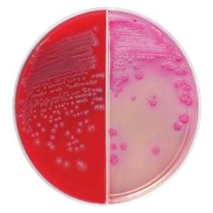 Blood Culture Biplate 100/Pk