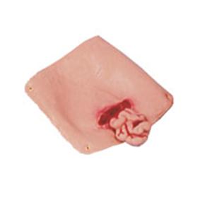 1 Abdominal Wound Training Manikin Ea