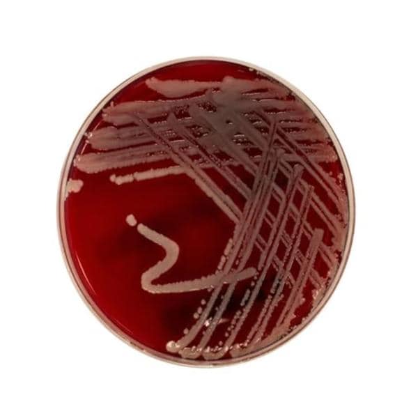 Culture TSA: Trypticase Soy Agar Spacesaver Plate 10/Pk