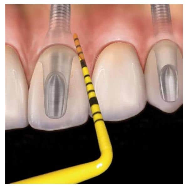 Colorvue PCV12KIT6 Periodontal Probe Henry Schein Dental