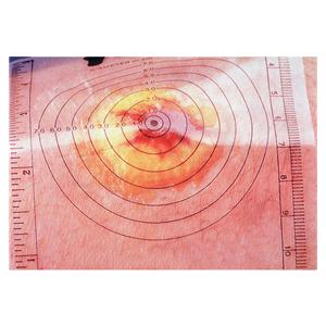 Measuring Sheet For Wound 250/BX