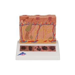 3B Scientific Skin Cancer Training Model Ea