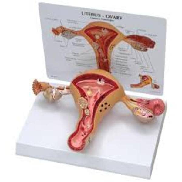 3B Scientific Uterus/Ovary Training Model Ea