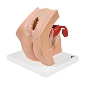 3B Scientific Gynecological Gynecological Training Model Ea