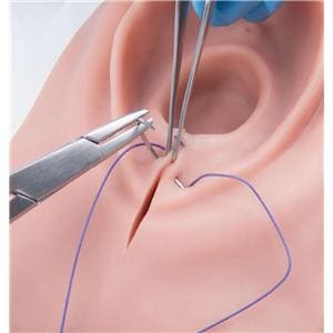 Episiotomy/Suturing Training Simulator Ea
