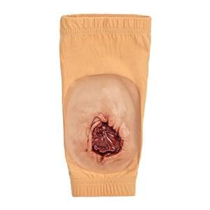 STOPS Medical Brachial Wound Moulage Sleeve Ea
