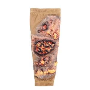 STOPS Medical Lower Leg Skin Burn Sleeve Ea