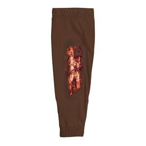 STOPS Medical Radial/Ulna Fracture Leg Sleeve Ea